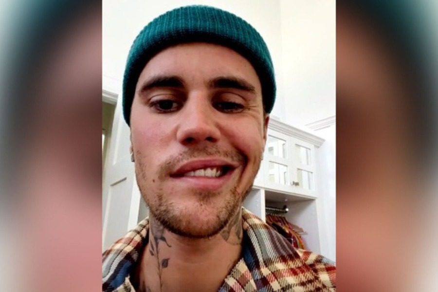 Justin Bieber: Συνεχίζει τη μάχη ‑ Έχει παραλύσει το πρόσωπο του