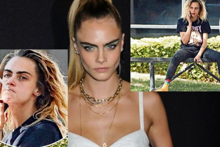 Cara Delevingne: Σε άθλια κατάσταση το διάσημο μοντέλο