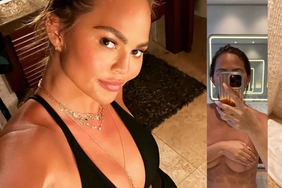 Η Chrissy Teigen ποζάρει γυμνή για να δείξει το απόλυτο bikini fail