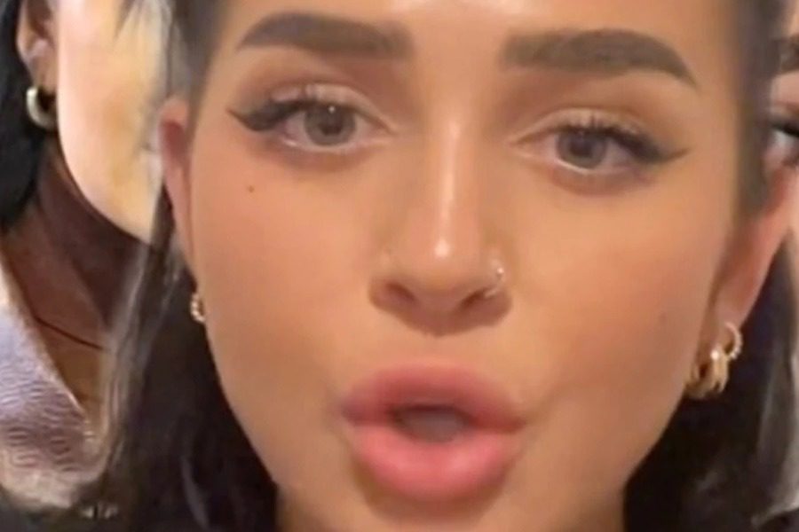 Διάσημη YouTuber παραδέχεται πως παραμόρφωσε το πρόσωπό της από τα fillers