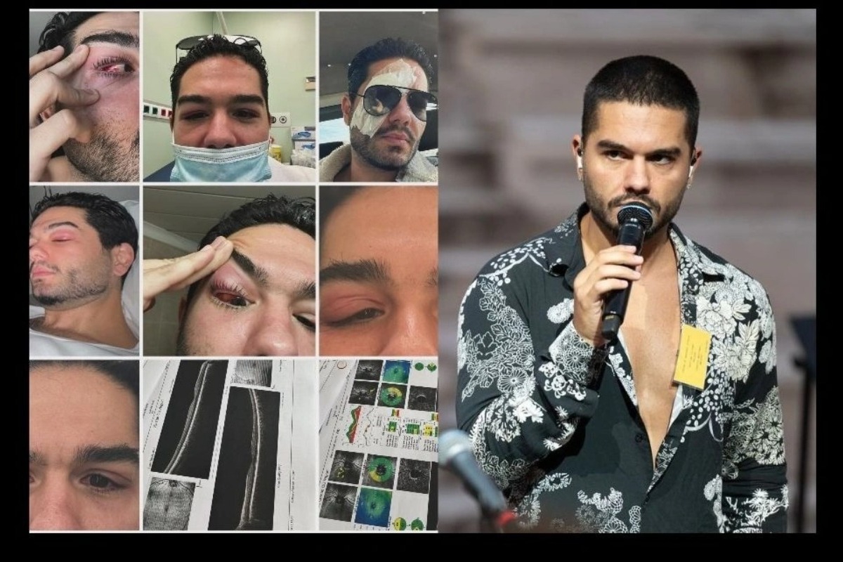 Χρήστος Μάστορας: Δείχνει το πρόσωπό του και τα σημάδια μετά το πρόβλημα υγείας που αντιμετώπισε