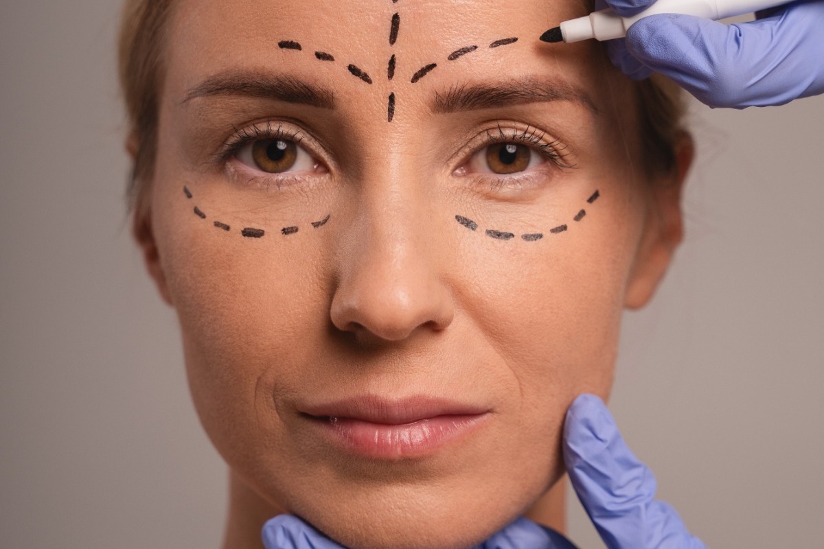 Aυτές οι πλαστικές επεμβάσεις θα είναι τα trends του 2026