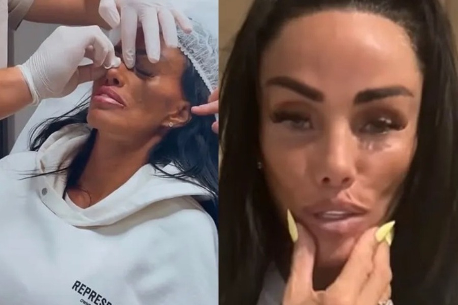 Κέιτι Πράις: «Έχω παραμορφωθεί» – Δυσκολεύεται να μιλήσει μετά την τελευταία επέμβαση