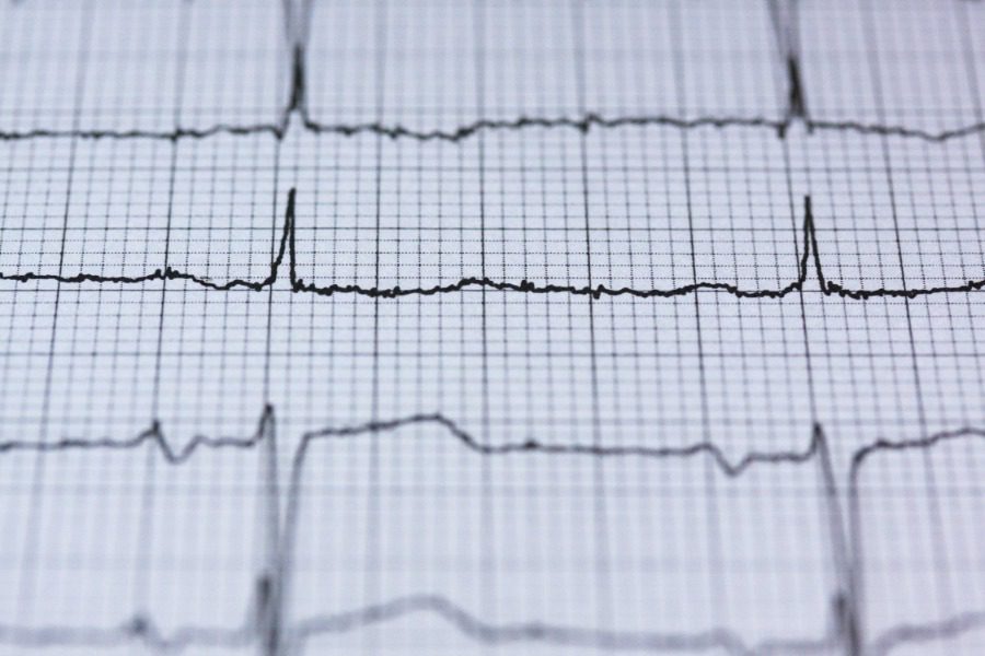 Τα σημάδια που μαρτυρούν ότι έχετε φραγμένες αρτηρίες